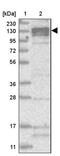 ATPase Phospholipid Transporting 11B (Putative) antibody, PA5-57578, Invitrogen Antibodies, Western Blot image 