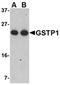 Glutathione S-Transferase Pi 1 antibody, orb74920, Biorbyt, Western Blot image 