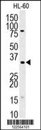 Translin Associated Factor X antibody, 57-371, ProSci, Western Blot image 