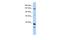 DEAH-Box Helicase 37 antibody, A14858, Boster Biological Technology, Western Blot image 