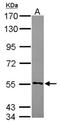 Cytochrome b5 reductase 4 antibody, NBP2-16049, Novus Biologicals, Western Blot image 