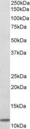 Beta-2-Microglobulin antibody, TA311281, Origene, Western Blot image 