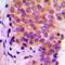 Galectin 9 antibody, LS-C352462, Lifespan Biosciences, Immunohistochemistry paraffin image 