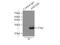 Acidic Nuclear Phosphoprotein 32 Family Member B antibody, 10843-1-AP, Proteintech Group, Immunoprecipitation image 