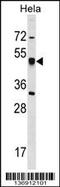 Cartilage Associated Protein antibody, 58-911, ProSci, Western Blot image 