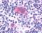 C-X-C Motif Chemokine Receptor 1 antibody, NLS806, Novus Biologicals, Immunohistochemistry paraffin image 