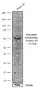 Acetylcholine Receptor antibody, 711098, Invitrogen Antibodies, Western Blot image 