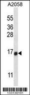 Testis Expressed 261 antibody, MBS9212704, MyBioSource, Western Blot image 