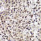 Checkpoint Kinase 2 antibody, LS-C331943, Lifespan Biosciences, Immunohistochemistry paraffin image 