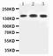 Nuclear Receptor Coactivator 3 antibody, PA2277, Boster Biological Technology, Western Blot image 