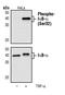 NFKB Inhibitor Alpha antibody, MA5-15087, Invitrogen Antibodies, Western Blot image 