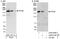 Pogo Transposable Element Derived With ZNF Domain antibody, A302-509A, Bethyl Labs, Western Blot image 