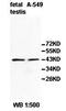 Pyruvate Dehydrogenase E1 Alpha 2 Subunit antibody, orb77896, Biorbyt, Western Blot image 