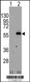 Myocyte Enhancer Factor 2C antibody, 62-220, ProSci, Western Blot image 