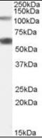 O-Linked N-Acetylglucosamine (GlcNAc) Transferase antibody, orb88267, Biorbyt, Western Blot image 