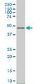 LIM Homeobox 4 antibody, MA5-22832, Invitrogen Antibodies, Western Blot image 