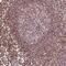 DEAD/H-Box Helicase 11 antibody, PA5-64202, Invitrogen Antibodies, Immunohistochemistry paraffin image 