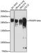 Platelet Derived Growth Factor Receptor Beta antibody, GTX32777, GeneTex, Western Blot image 