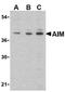 CD5 Molecule Like antibody, orb108955, Biorbyt, Western Blot image 
