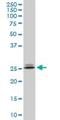 Phosphoethanolamine/phosphocholine phosphatase antibody, H00162466-M10, Novus Biologicals, Western Blot image 