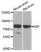 N-Ethylmaleimide Sensitive Factor, Vesicle Fusing ATPase antibody, A0926, ABclonal Technology, Western Blot image 