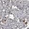 Tether containing UBX domain for GLUT4 antibody, NBP1-90079, Novus Biologicals, Immunohistochemistry frozen image 