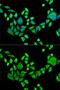 SH3 Domain Containing GRB2 Like 2, Endophilin A1 antibody, GTX32872, GeneTex, Immunofluorescence image 