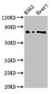 L3MBTL Histone Methyl-Lysine Binding Protein 2 antibody, LS-C678474, Lifespan Biosciences, Western Blot image 