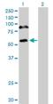 RNA Binding Motif Protein 6 antibody, H00010180-M16, Novus Biologicals, Western Blot image 