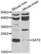 Spermidine/Spermine N1-Acetyltransferase Family Member 2 antibody, A04174, Boster Biological Technology, Western Blot image 