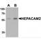 HEPACAM Family Member 2 antibody, MBS153640, MyBioSource, Western Blot image 