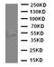 Mucosal Vascular Addressin Cell Adhesion Molecule 1 antibody, LS-C313201, Lifespan Biosciences, Western Blot image 