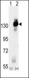 Colony Stimulating Factor 1 Receptor antibody, LS-C100250, Lifespan Biosciences, Western Blot image 