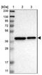 Transmembrane Protein 19 antibody, NBP1-90422, Novus Biologicals, Western Blot image 