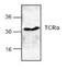 T Cell Receptor Alpha Constant antibody, NBP1-45883, Novus Biologicals, Western Blot image 