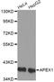 Apurinic/Apyrimidinic Endodeoxyribonuclease 1 antibody, STJ22638, St John