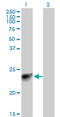 Myosin Light Chain 3 antibody, LS-C197731, Lifespan Biosciences, Western Blot image 
