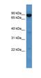 ATP Binding Cassette Subfamily B Member 10 antibody, orb330333, Biorbyt, Western Blot image 