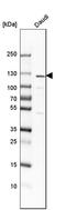 Nuclear Factor Kappa B Subunit 1 antibody, HPA027305, Atlas Antibodies, Western Blot image 