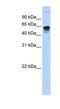 Regulator Of Microtubule Dynamics 3 antibody, NBP1-62474, Novus Biologicals, Western Blot image 