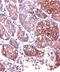 Lysophospholipase 1 antibody, GTX66442, GeneTex, Immunohistochemistry paraffin image 