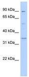 Wnt Family Member 9B antibody, TA344060, Origene, Western Blot image 