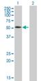 Actin Binding LIM Protein Family Member 3 antibody, H00022885-B01P, Novus Biologicals, Western Blot image 