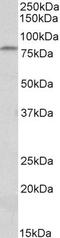 CD97 antigen antibody, PA5-37938, Invitrogen Antibodies, Western Blot image 