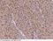 CD248 Molecule antibody, 102031-T08, Sino Biological, Immunohistochemistry frozen image 