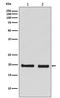 S-Phase Kinase Associated Protein 1 antibody, M00476, Boster Biological Technology, Western Blot image 