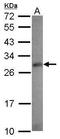 Ras Association Domain Family Member 4 antibody, GTX120387, GeneTex, Western Blot image 