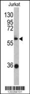 Zinc Finger And BTB Domain Containing 2 antibody, 62-443, ProSci, Western Blot image 