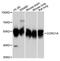 Coronin 1A antibody, A9300, ABclonal Technology, Western Blot image 