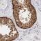 ADSL antibody, NBP1-87406, Novus Biologicals, Immunohistochemistry paraffin image 